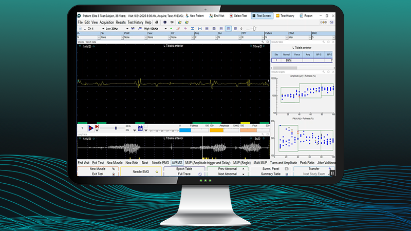 Audio-Visual electromyography (