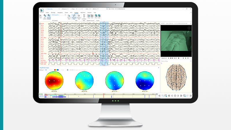 BQ Hardware Seamless EEG Software Feature