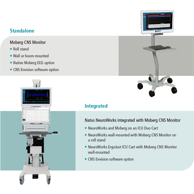 Moberg CNS Configuration
