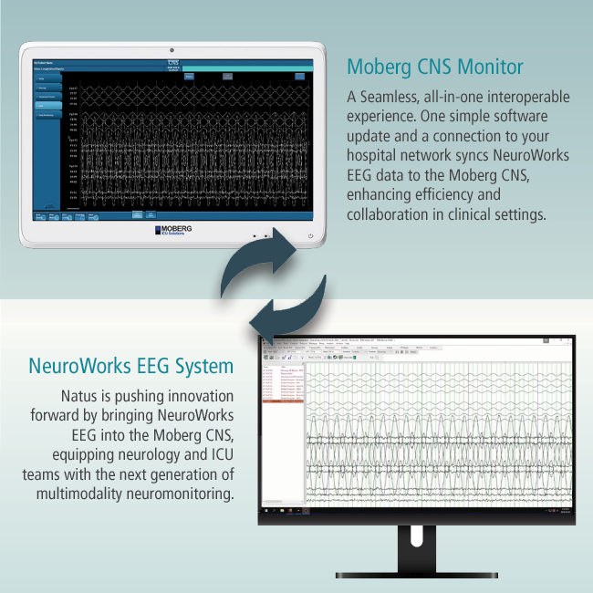 Moberg Integration with NW