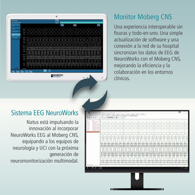Moberg Integration with NW - ES