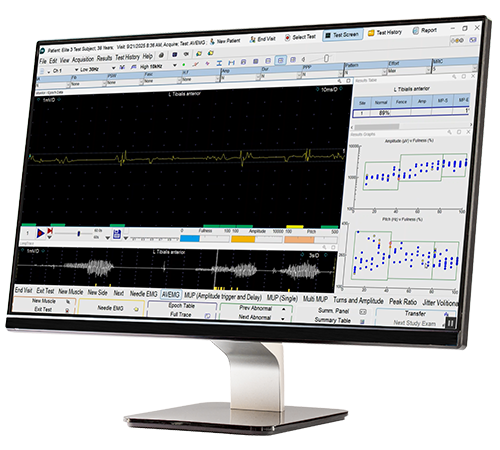 Natus Elite EMG software