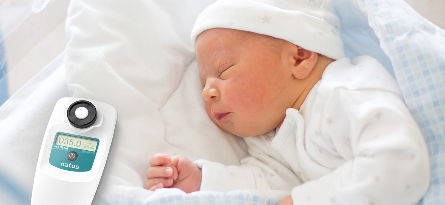 neoBLUE® Radiometer for Newborn Jaundice Treatment Natus